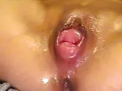 Pieniądze zawsze są potrzebne i tej bramce też